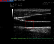 ultrasound image