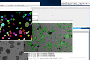 Fiji Is An Image Processing Package Based On Imagej